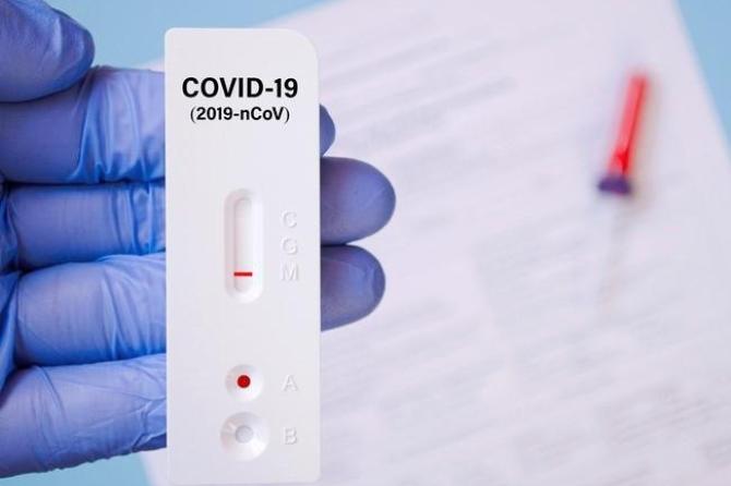 SARS-CoV-2 Testing Strategies
